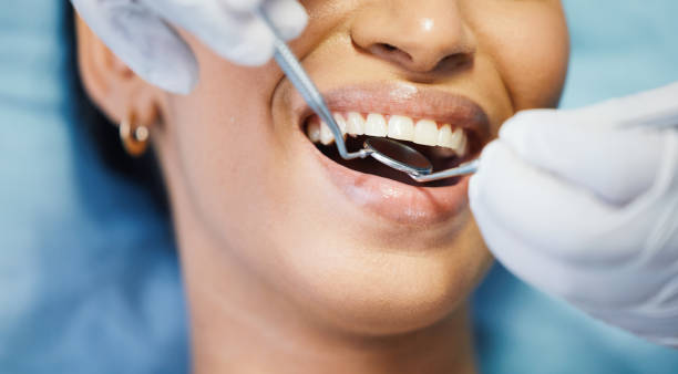 Best Emergency Dental Filling Replacement  in Triana, AL