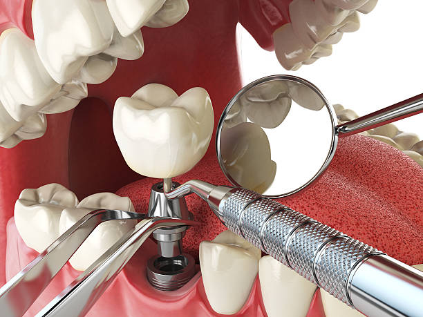 Best Cracked Tooth Emergency Dentist  in Triana, AL